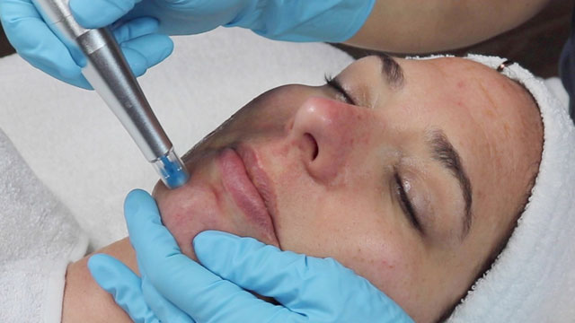Rezenerate Facial